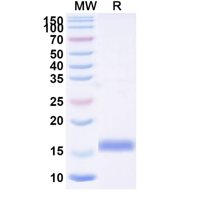 SDS-PAGE - Anti-SARS-CoV-2 Spike Protein Nanobody [SAA0989] (A338046) - Antibodies.com