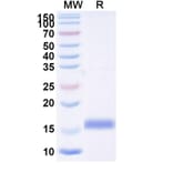SDS-PAGE - Anti-SARS-CoV-2 Spike Protein Nanobody [SAA0989] (A338046) - Antibodies.com