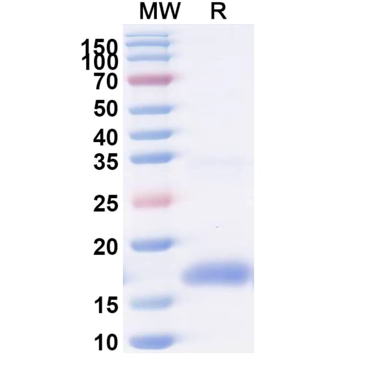 SDS-PAGE - Anti-SARS-CoV-2 Spike Protein Nanobody [SAA0996] (A338047) - Antibodies.com