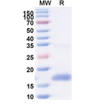 SDS-PAGE - Anti-SARS-CoV-2 Spike Protein Nanobody [SAA0996] (A338047) - Antibodies.com