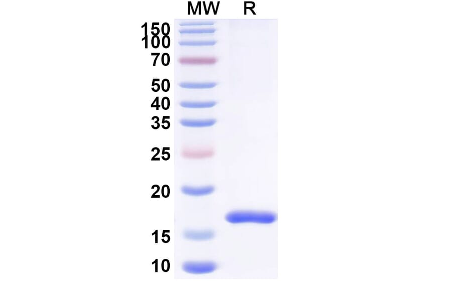 SDS-PAGE - Anti-SARS-CoV-2 Spike Protein Nanobody [SAA1022] (A338048) - Antibodies.com