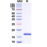 SDS-PAGE - Anti-SARS-CoV-2 Spike Protein Nanobody [SAA1022] (A338048) - Antibodies.com