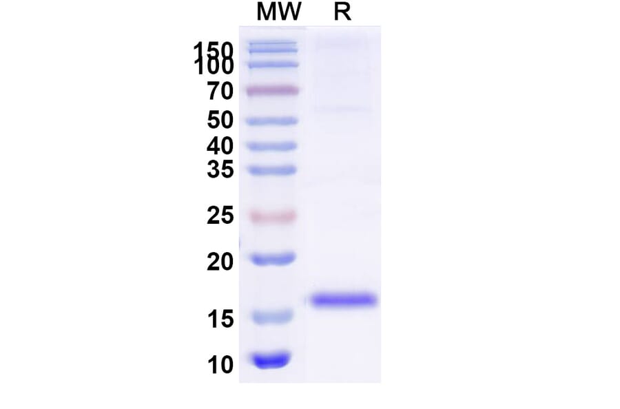 SDS-PAGE - Anti-SARS-CoV-2 Spike Protein Nanobody [SAA1027] (A338049) - Antibodies.com