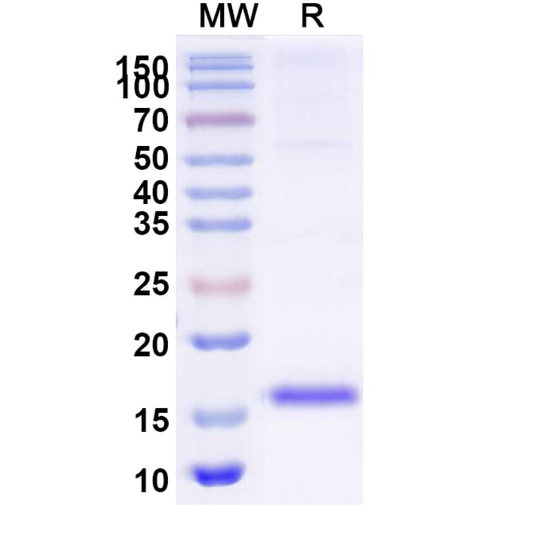 SDS-PAGE - Anti-SARS-CoV-2 Spike Protein Nanobody [SAA1027] (A338049) - Antibodies.com