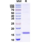 SDS-PAGE - Anti-SARS-CoV-2 Spike Protein Nanobody [SAA1027] (A338049) - Antibodies.com