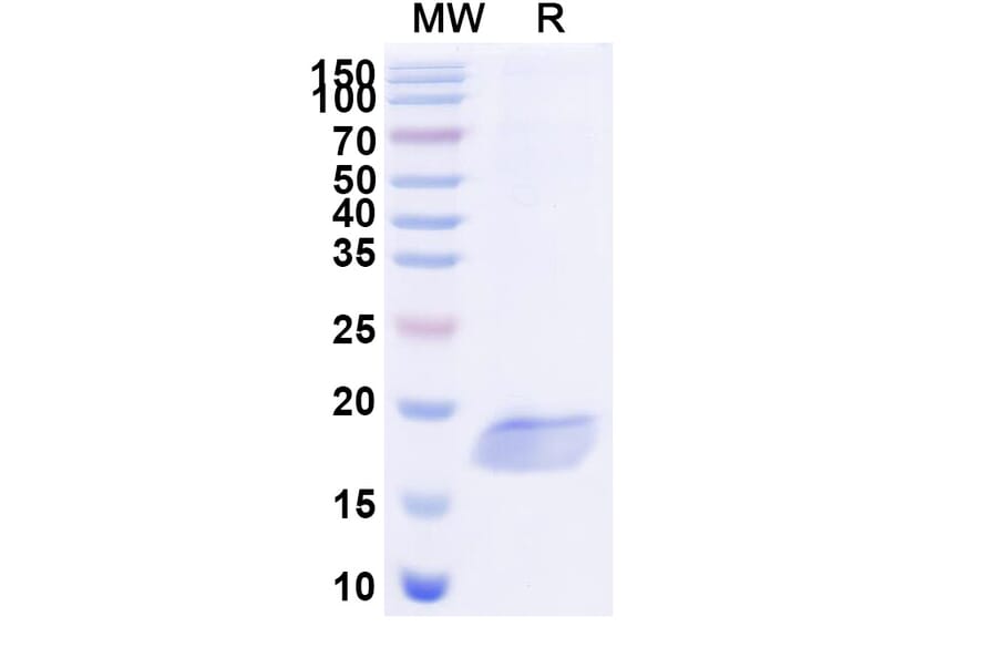SDS-PAGE - Anti-SARS-CoV-2 Spike Protein Nanobody [SAA1028] (A338050) - Antibodies.com