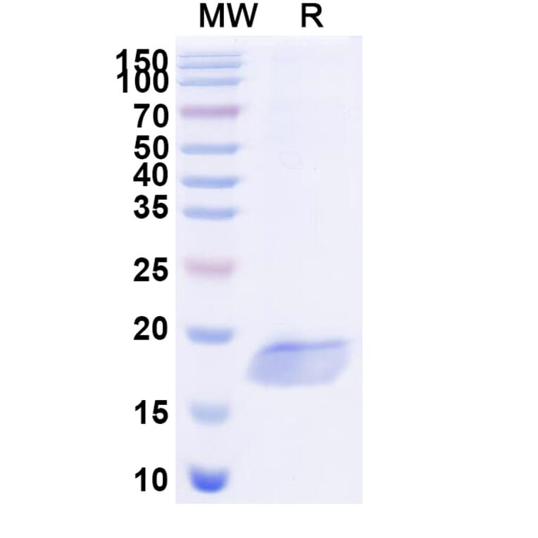 SDS-PAGE - Anti-SARS-CoV-2 Spike Protein Nanobody [SAA1028] (A338050) - Antibodies.com
