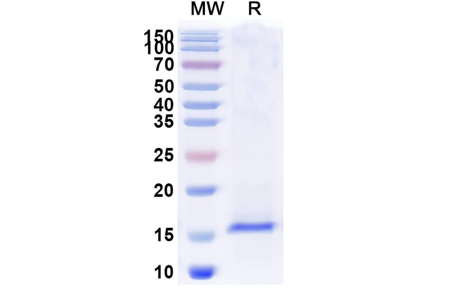 SDS-PAGE - Anti-SARS-CoV-2 Spike Protein Nanobody [SAA1043] (A338051) - Antibodies.com