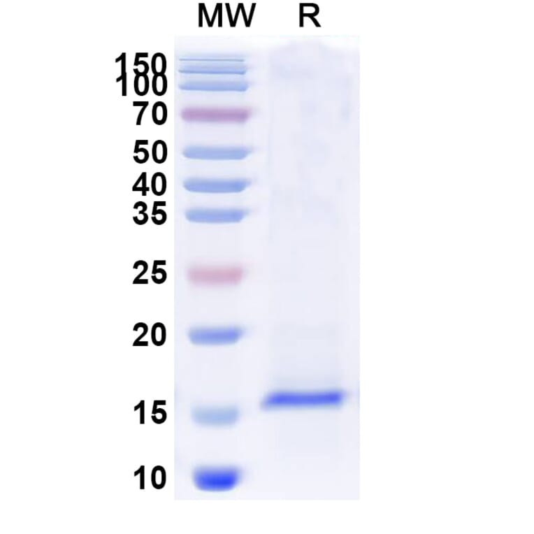 SDS-PAGE - Anti-SARS-CoV-2 Spike Protein Nanobody [SAA1043] (A338051) - Antibodies.com