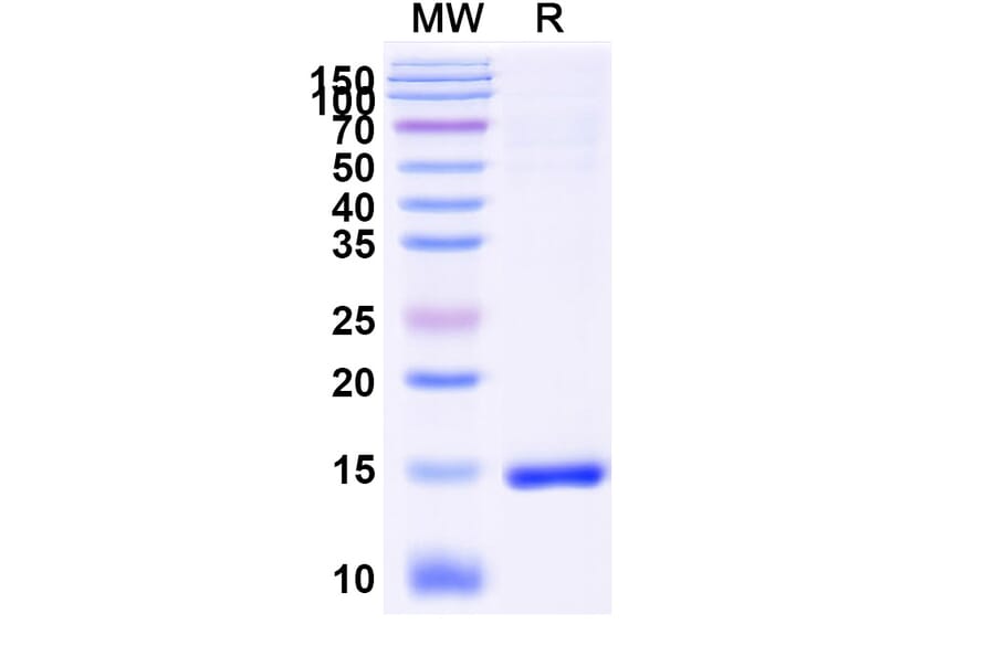 SDS-PAGE - Anti-SARS-CoV-2 Spike Protein Nanobody [SAA1048] (A338052) - Antibodies.com