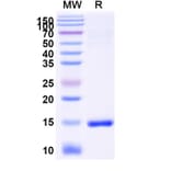 SDS-PAGE - Anti-SARS-CoV-2 Spike Protein Nanobody [SAA1048] (A338052) - Antibodies.com