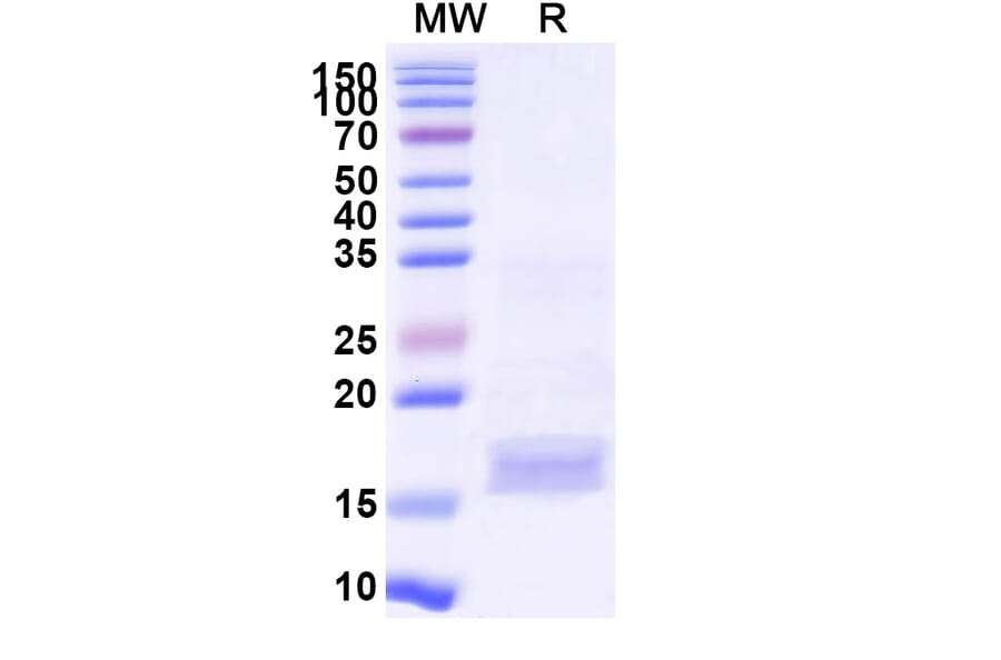 SDS-PAGE - Anti-SARS-CoV-2 Spike Protein Nanobody [SAA1049] (A338053) - Antibodies.com
