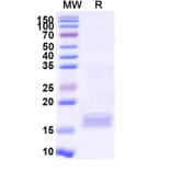 SDS-PAGE - Anti-SARS-CoV-2 Spike Protein Nanobody [SAA1049] (A338053) - Antibodies.com