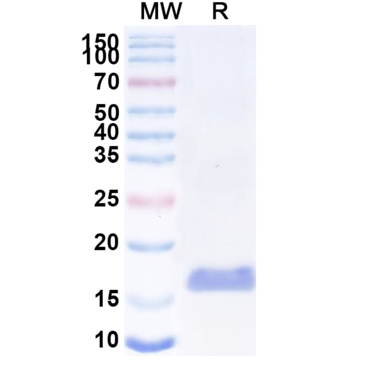 SDS-PAGE - Anti-SARS-CoV-2 Spike Protein Nanobody [SAA1057] (A338054) - Antibodies.com