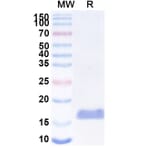 SDS-PAGE - Anti-SARS-CoV-2 Spike Protein Nanobody [SAA1057] (A338054) - Antibodies.com