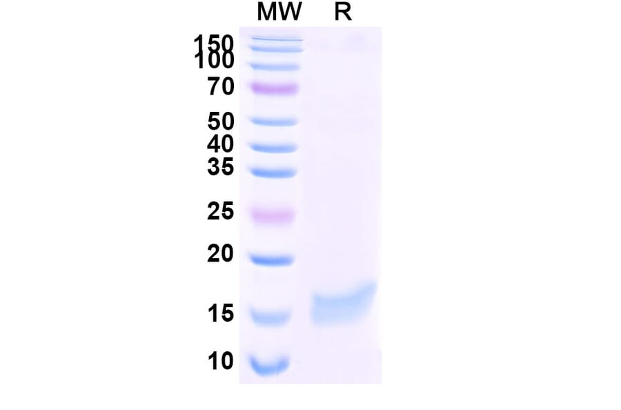 SDS-PAGE - Anti-SARS-CoV-2 Spike Protein Nanobody [SAA1058] (A338055) - Antibodies.com