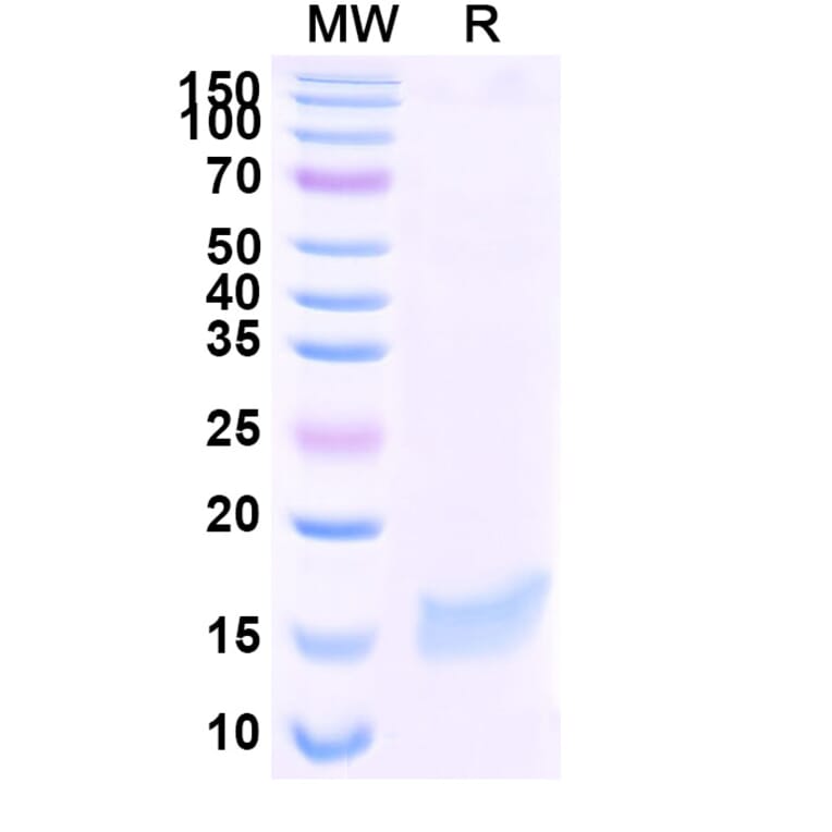 SDS-PAGE - Anti-SARS-CoV-2 Spike Protein Nanobody [SAA1058] (A338055) - Antibodies.com