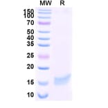 SDS-PAGE - Anti-SARS-CoV-2 Spike Protein Nanobody [SAA1058] (A338055) - Antibodies.com