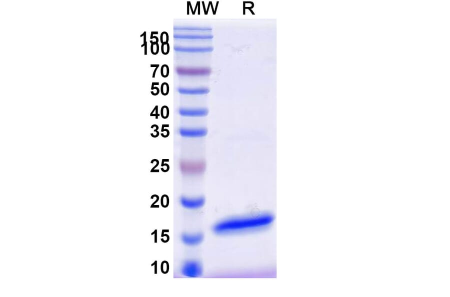 SDS-PAGE - Anti-SARS-CoV-2 Spike Protein Nanobody [SAA1059] (A338056) - Antibodies.com