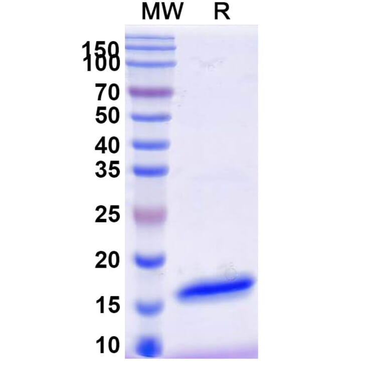 SDS-PAGE - Anti-SARS-CoV-2 Spike Protein Nanobody [SAA1059] (A338056) - Antibodies.com