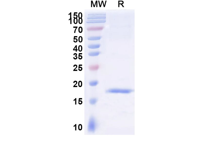 SDS-PAGE - Anti-SARS-CoV-2 Spike Protein Nanobody [SAA1061] (A338058) - Antibodies.com