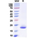 SDS-PAGE - Anti-SARS-CoV-2 Spike Protein Nanobody [SAA1062] (A338059) - Antibodies.com
