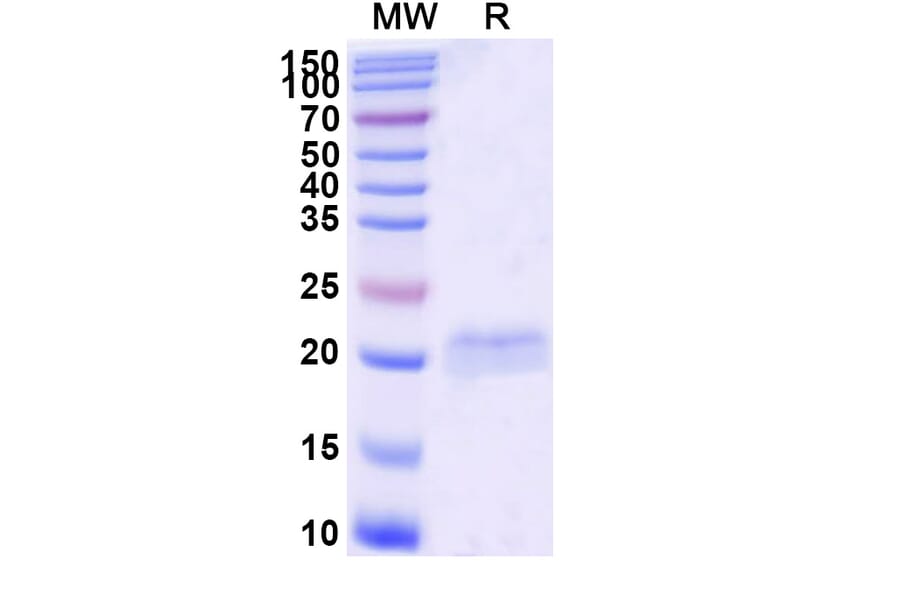 SDS-PAGE - Anti-SARS-CoV-2 Spike Protein Nanobody [SAA1063] (A338060) - Antibodies.com