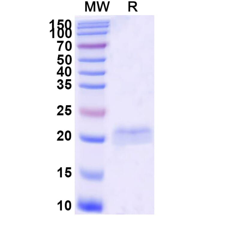 SDS-PAGE - Anti-SARS-CoV-2 Spike Protein Nanobody [SAA1063] (A338060) - Antibodies.com