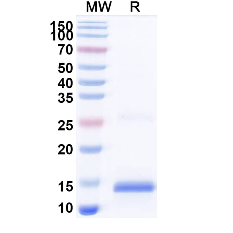 SDS-PAGE - Anti-SARS-CoV-2 Spike Protein Nanobody [SAA1064] (A338061) - Antibodies.com