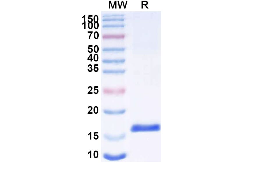 SDS-PAGE - Anti-SARS-CoV-2 Spike Protein Nanobody [SAA1066] (A338062) - Antibodies.com
