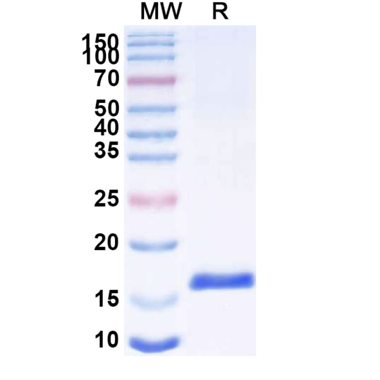 SDS-PAGE - Anti-SARS-CoV-2 Spike Protein Nanobody [SAA1066] (A338062) - Antibodies.com