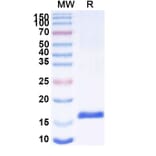 SDS-PAGE - Anti-SARS-CoV-2 Spike Protein Nanobody [SAA1066] (A338062) - Antibodies.com