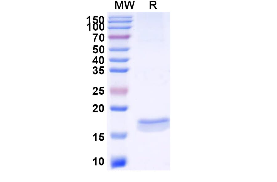 SDS-PAGE - Anti-SARS-CoV-2 Spike Protein Nanobody [SAA1067] (A338063) - Antibodies.com