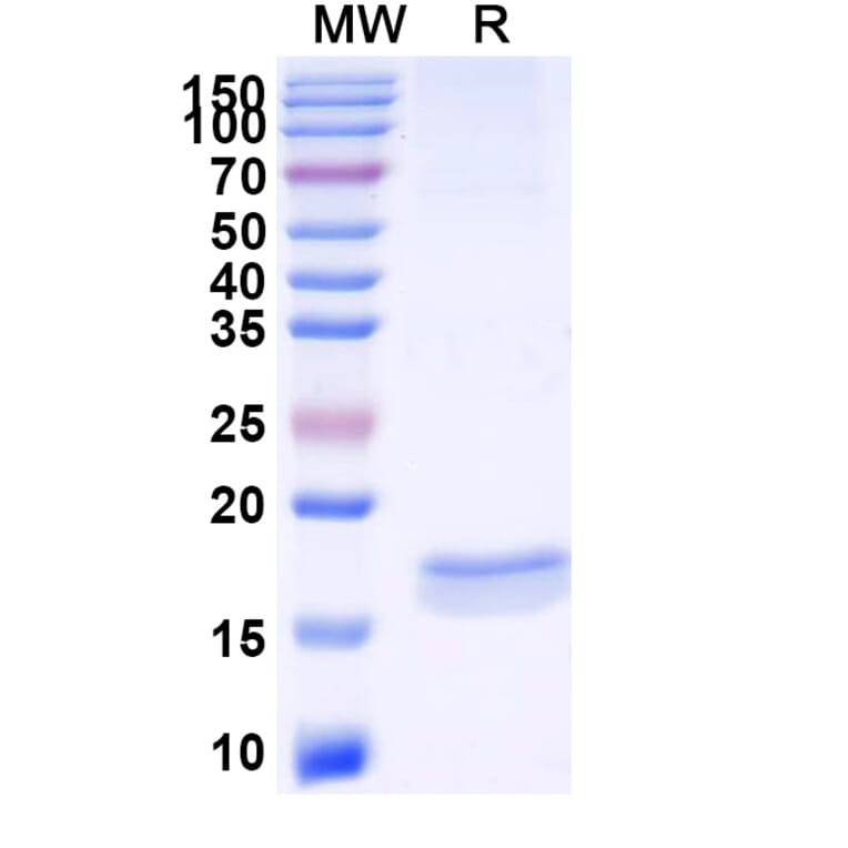 SDS-PAGE - Anti-SARS-CoV-2 Spike Protein Nanobody [SAA1067] (A338063) - Antibodies.com