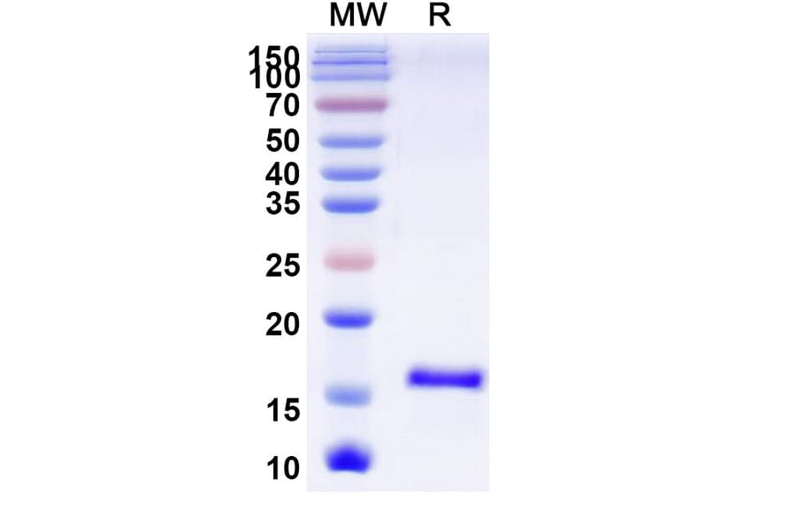 SDS-PAGE - Anti-SARS-CoV-2 Spike Protein Nanobody [SAA1068] (A338064) - Antibodies.com