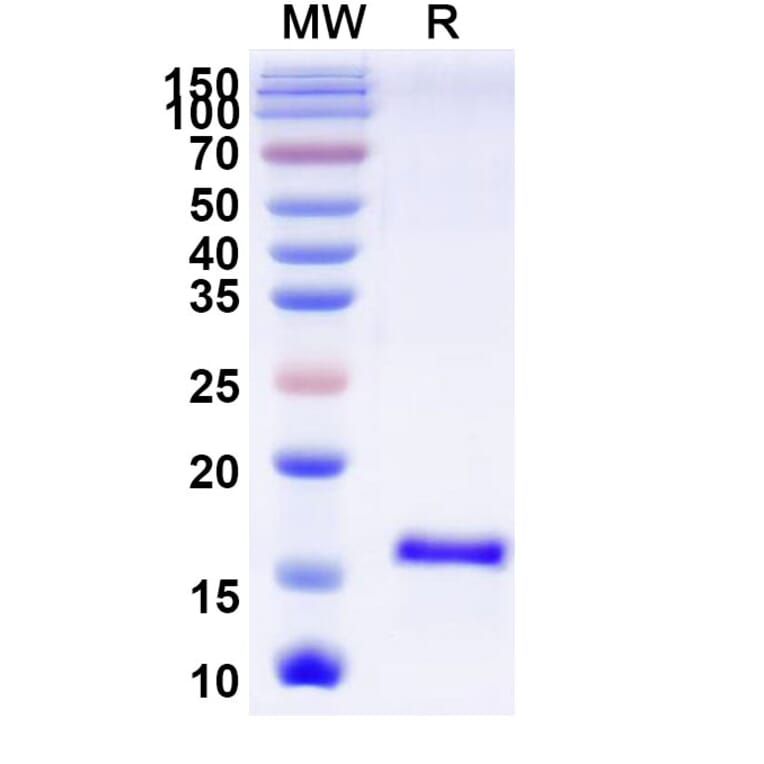 SDS-PAGE - Anti-SARS-CoV-2 Spike Protein Nanobody [SAA1068] (A338064) - Antibodies.com
