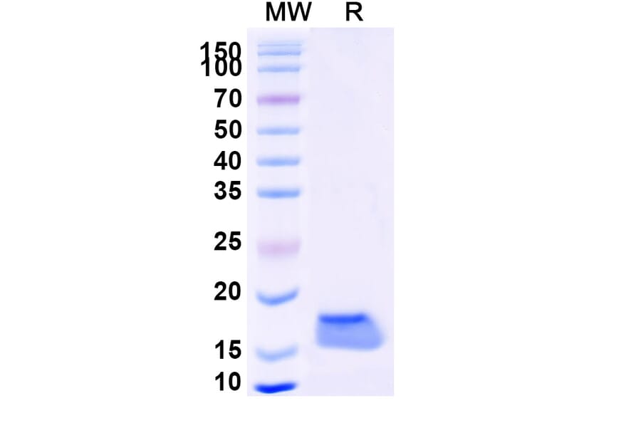SDS-PAGE - Anti-SARS-CoV-2 Spike Protein Nanobody [SAA1069] (A338065) - Antibodies.com