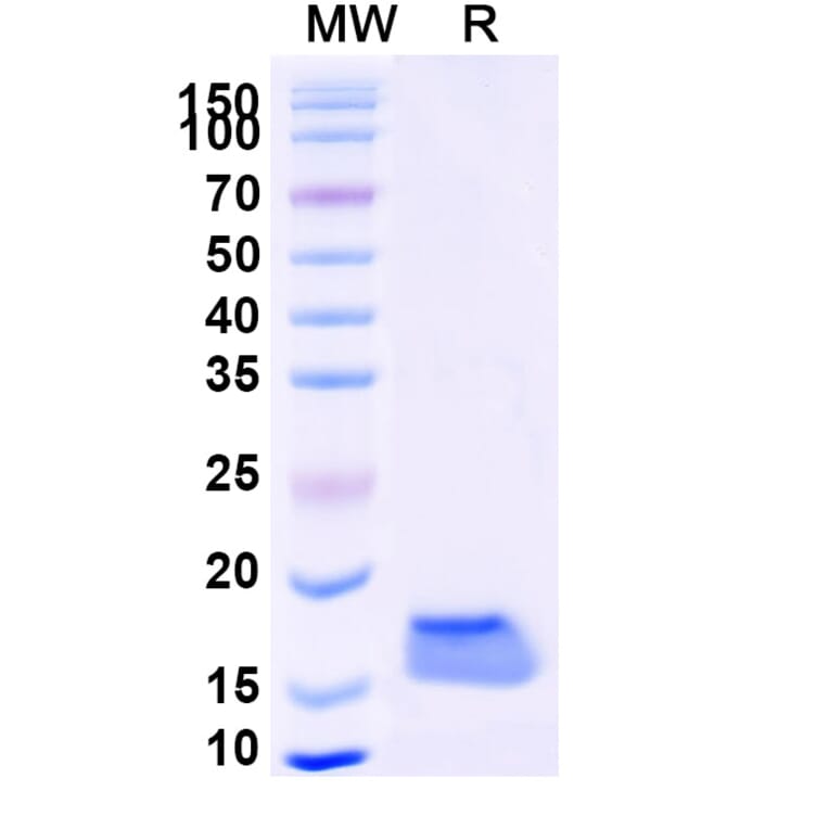 SDS-PAGE - Anti-SARS-CoV-2 Spike Protein Nanobody [SAA1069] (A338065) - Antibodies.com