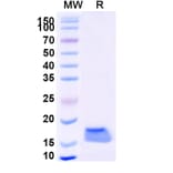 SDS-PAGE - Anti-SARS-CoV-2 Spike Protein Nanobody [SAA1069] (A338065) - Antibodies.com