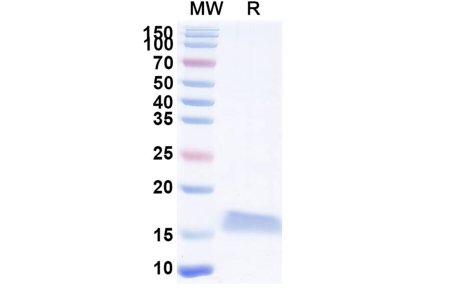 SDS-PAGE - Anti-SARS-CoV-2 Spike Protein Nanobody [SAA1070] (A338066) - Antibodies.com