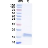 SDS-PAGE - Anti-SARS-CoV-2 Spike Protein Nanobody [SAA1070] (A338066) - Antibodies.com