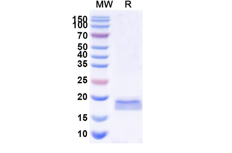 SDS-PAGE - Anti-SARS-CoV-2 Spike Protein Nanobody [SAA1071] (A338067) - Antibodies.com