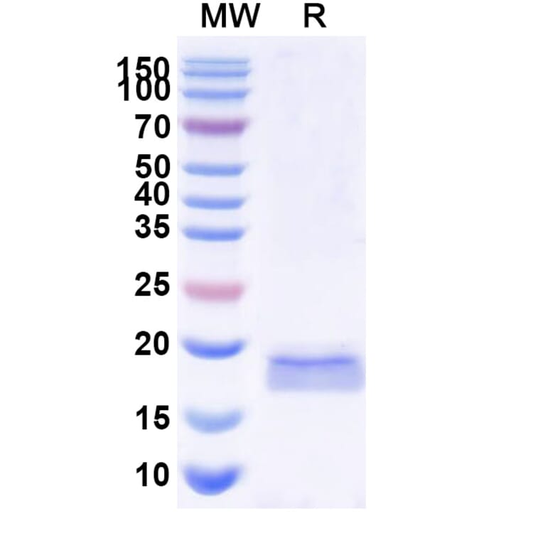 SDS-PAGE - Anti-SARS-CoV-2 Spike Protein Nanobody [SAA1071] (A338067) - Antibodies.com