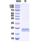 SDS-PAGE - Anti-SARS-CoV-2 Spike Protein Nanobody [SAA1071] (A338067) - Antibodies.com