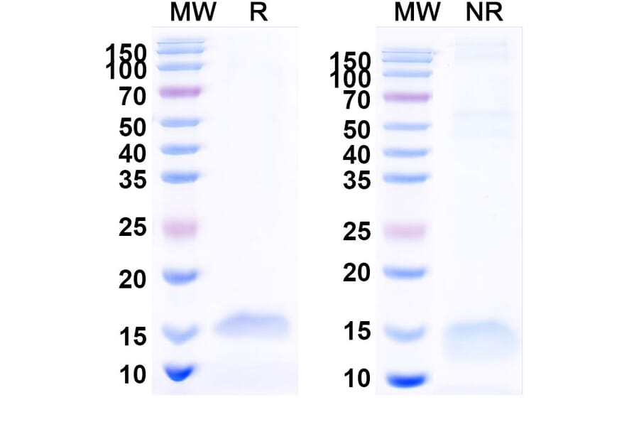 SDS-PAGE - Anti-SARS-CoV-2 Spike Protein Nanobody [SAA1072] (A338068) - Antibodies.com