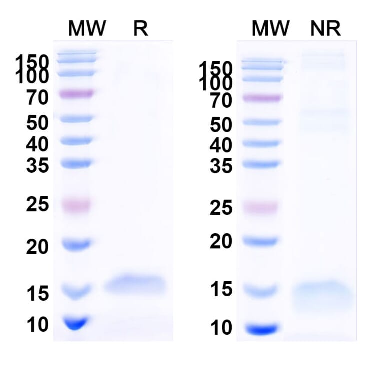 SDS-PAGE - Anti-SARS-CoV-2 Spike Protein Nanobody [SAA1072] (A338068) - Antibodies.com