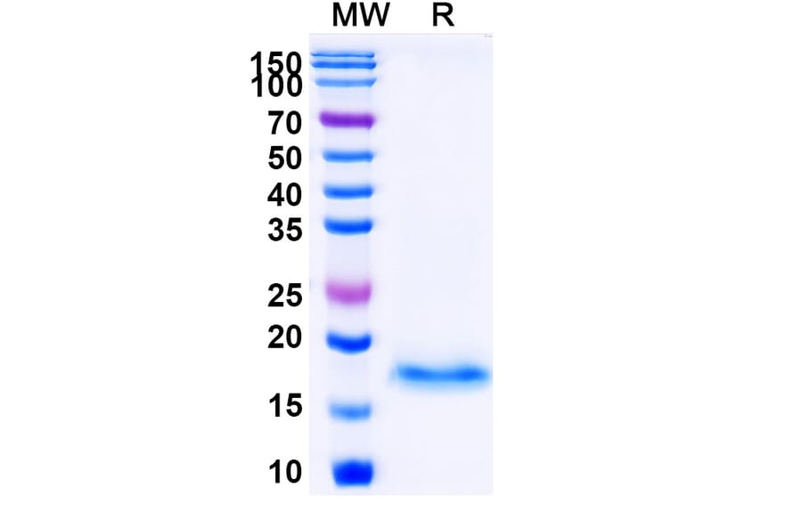 SDS-PAGE - Anti-SARS-CoV-2 Spike Protein Nanobody [SAA1073] (A338069) - Antibodies.com