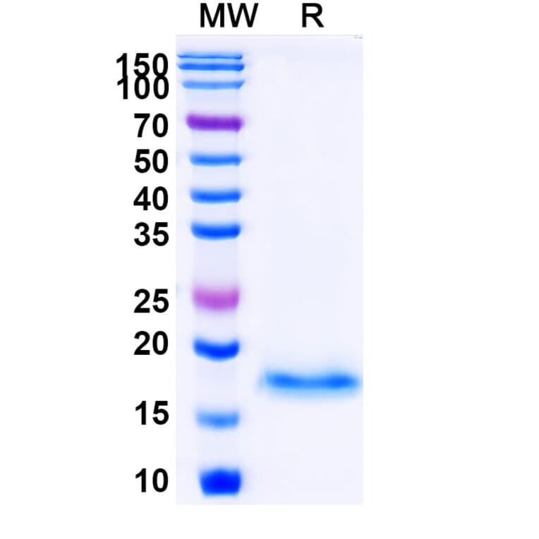 SDS-PAGE - Anti-SARS-CoV-2 Spike Protein Nanobody [SAA1073] (A338069) - Antibodies.com