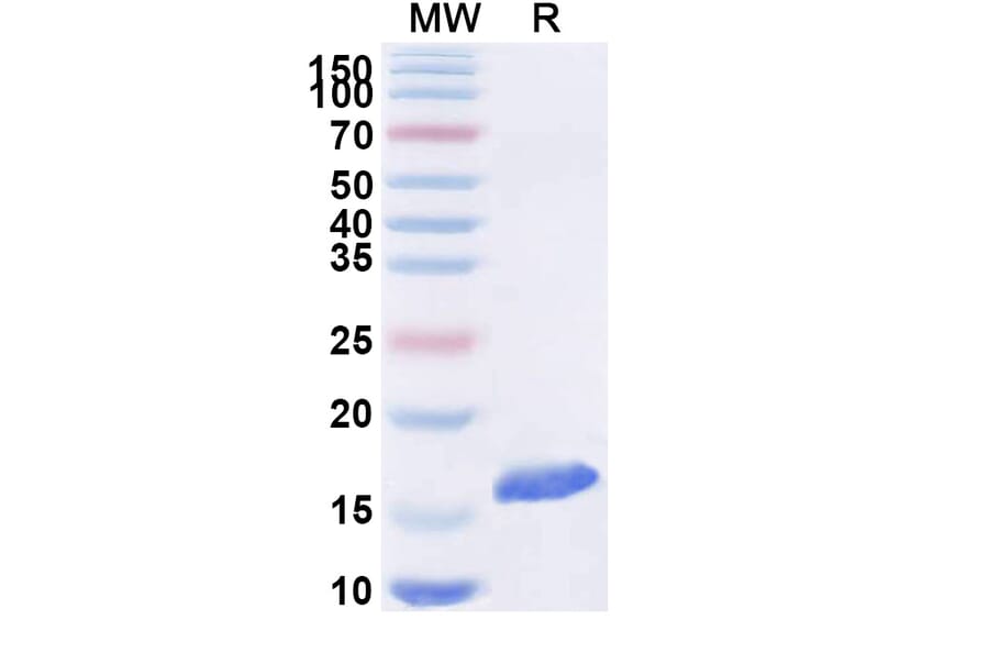 SDS-PAGE - Anti-SARS-CoV-2 Spike Protein Nanobody [SAA1074] (A338070) - Antibodies.com