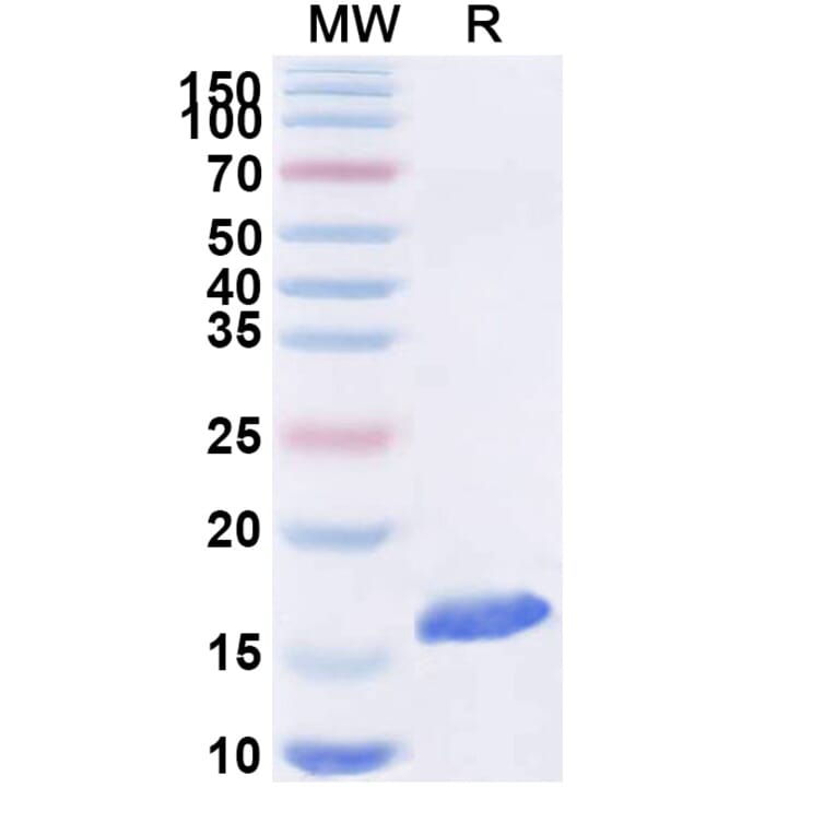 SDS-PAGE - Anti-SARS-CoV-2 Spike Protein Nanobody [SAA1074] (A338070) - Antibodies.com